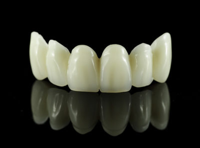 Restorative Dentistry Dental Bridges