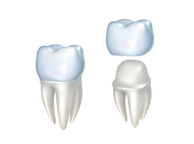 Restorative Dentistry Crowns