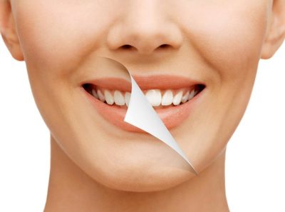 Cosmetic Dentistry Whitening