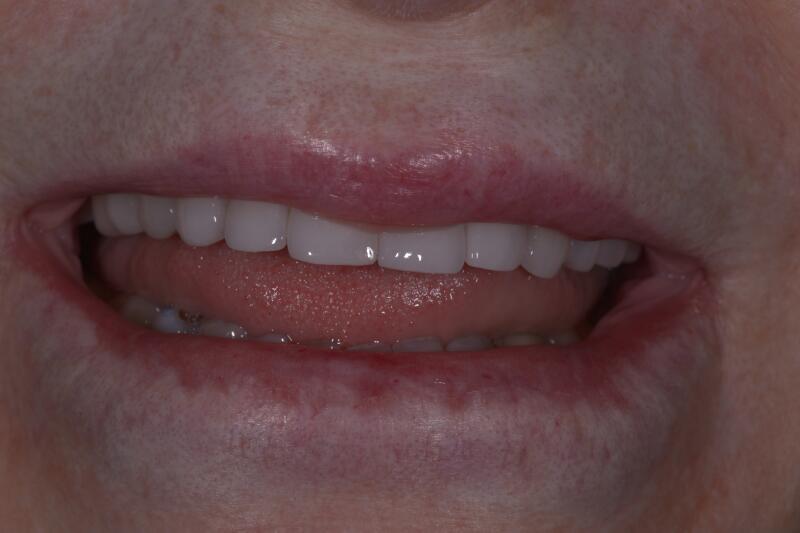 After