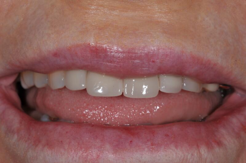Before