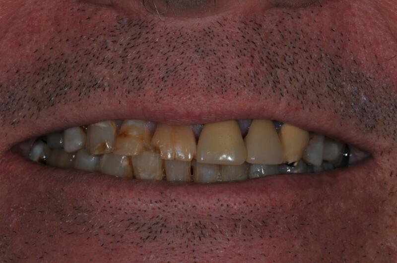 Before